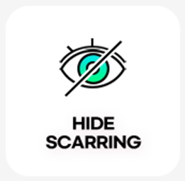HIDE SCARRING — 看不见的疤痕