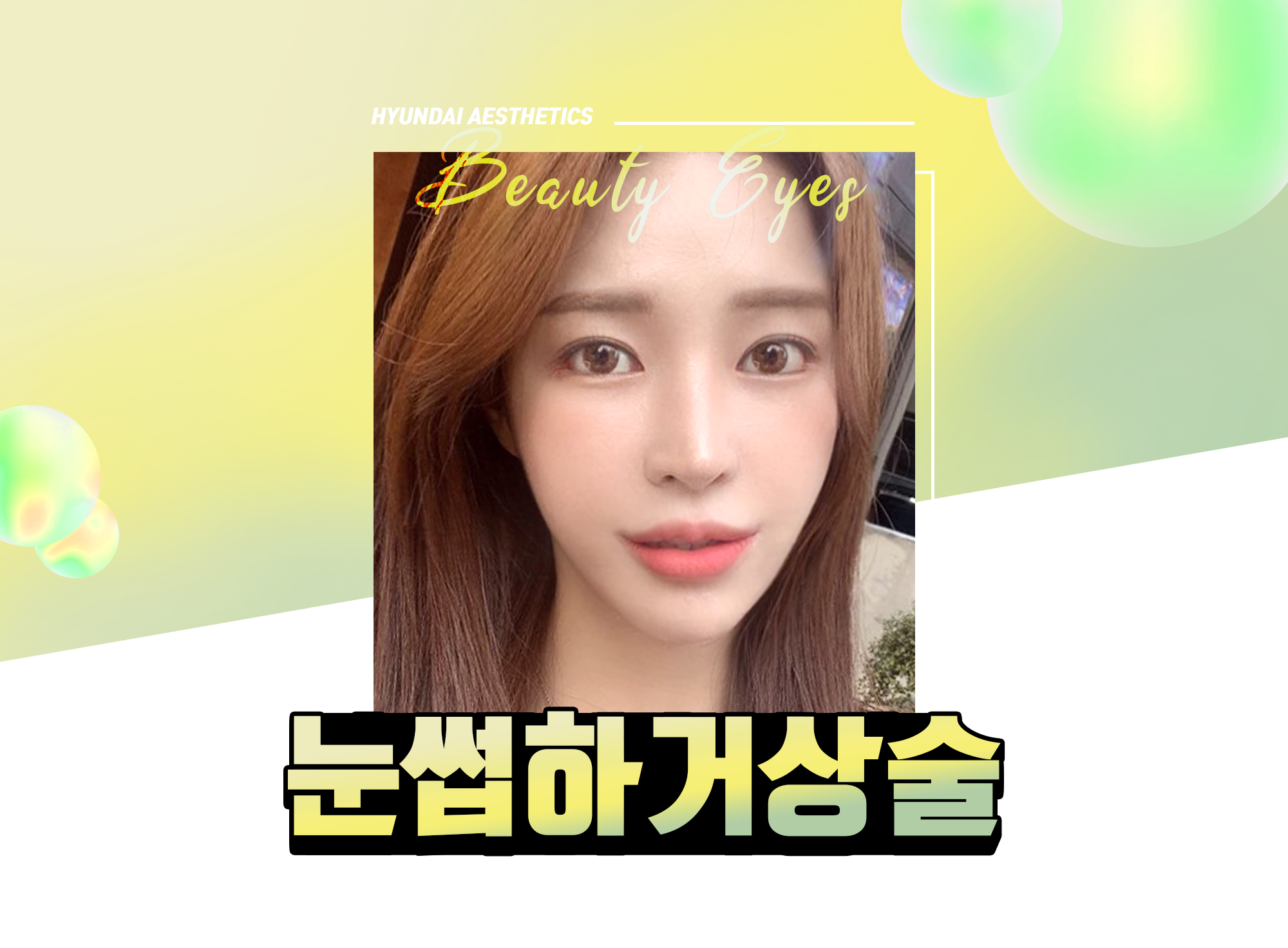 现代美学 眉下提升术 — HYUNDAI AESTHETICS Beauty Eyes,眉下提升术模特照片