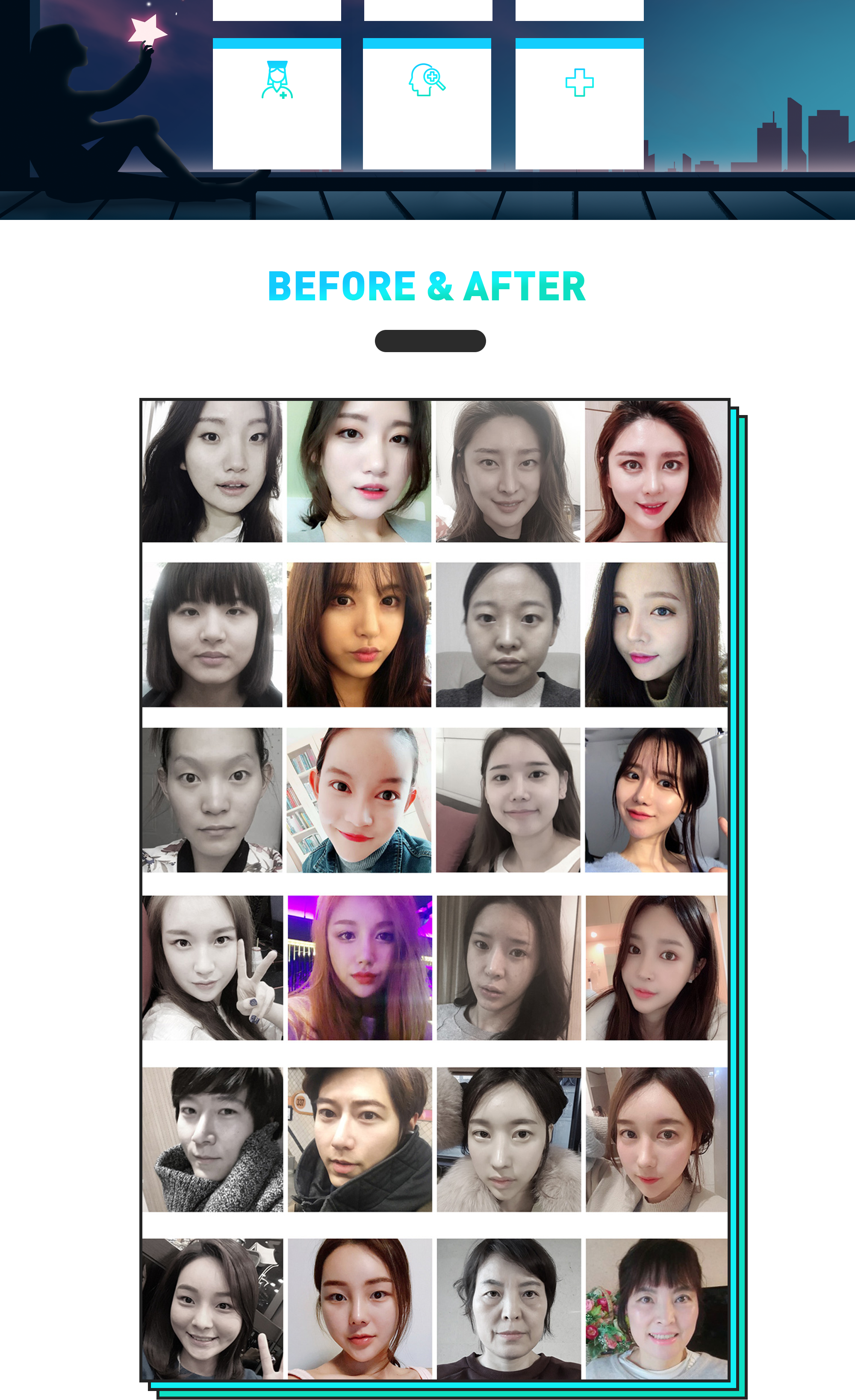 现代美学 开眼角修复手术护理系统及 BEFORE & AFTER 案例