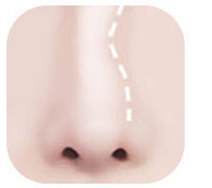 鼻梁歪斜鼻插图