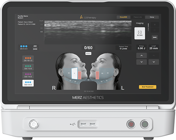 Ultherapy Prime DeepSEE 超声监测画面